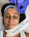 Online Micro+ Needling