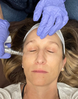 Holistic Micro+ Needling (in-person)